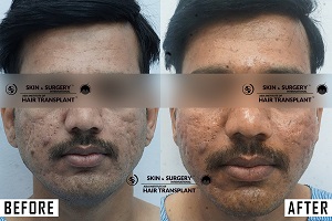 before and after results_4