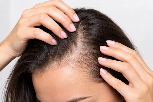 Evidence tiers of hair loss treatments: established, emerging, experimental