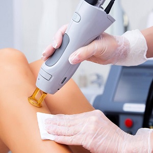 Laser Hair Treatment