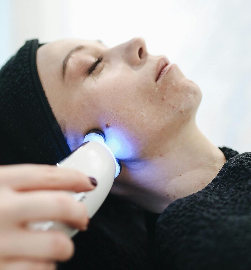 laser skin treatment in Pune for glowing skin