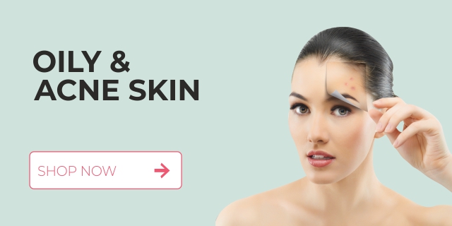 Oily & Acne Skin treatment