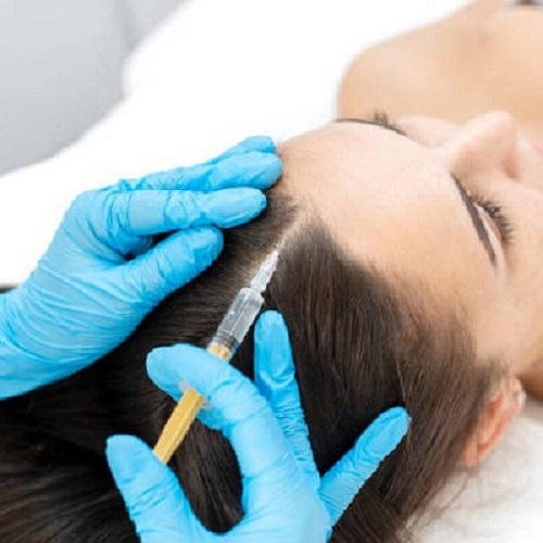 PRP Hair Treatment