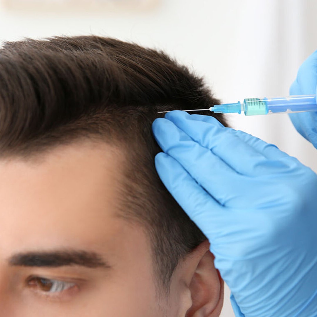 PRP therapy for hair growth procedure to reduce hair fall and improve hair density