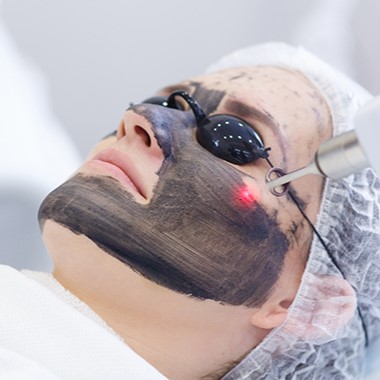 laser facial treatment for skin brightening in Pune