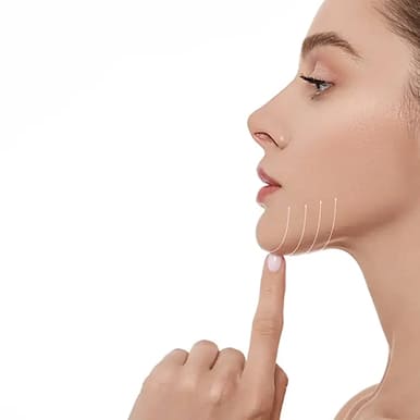 Areas Treated with Botox