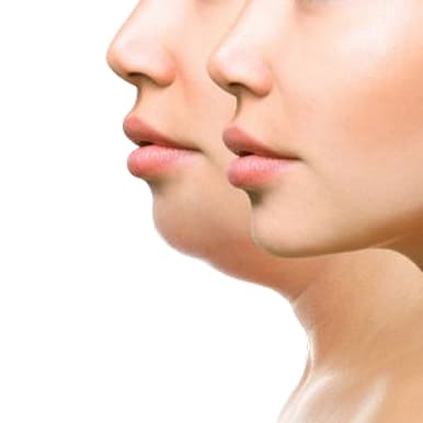 botox treatment in pune