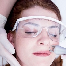 Laser Skin Resurfacing - skin dermatologist in pune