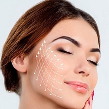 Thread Lift Treatment