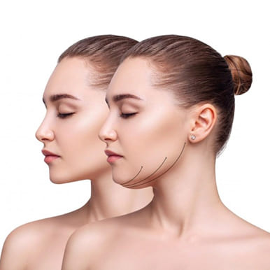 botox treatment for face