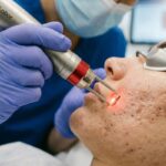 How Modern Techniques Help Reduce Deep Acne Scars