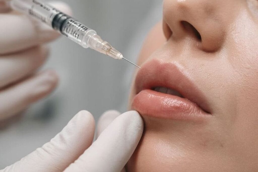 Lip Enhancement with Fillers – What to Expect Before and After lip-enhancement-with-fillers-before-and-after
