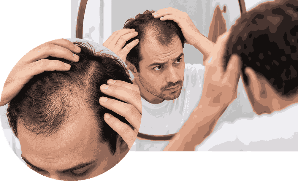 Dermatologist evaluating scalp and hair loss pattern before treatment
