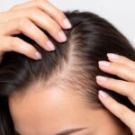 Illustration of hair follicle growth cycle used in hair loss diagnosis